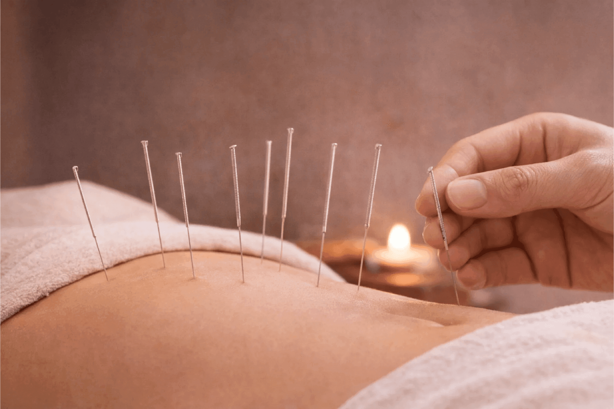 Acupuncture treatment